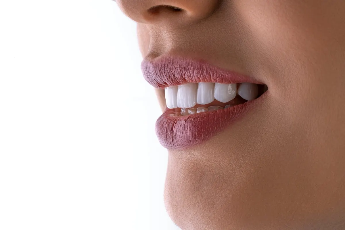 Close-up of a bright, even smile